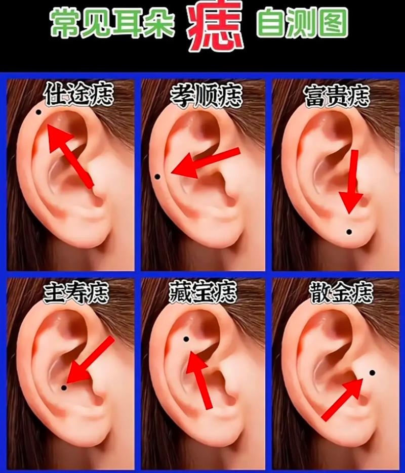耳朵长痣解读,耳珠有痣主财,左耳垂有痣象征福气与富贵。插图 耳朵长痣解读,耳珠有痣主财,左耳垂有痣象征福气与富贵。插图