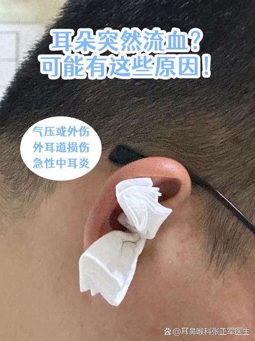 梦到耳朵流血需谨慎解读插图