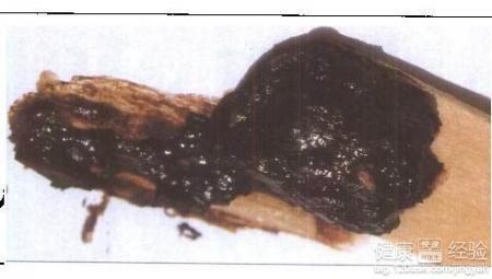 梦见大便，揭示身体能量与内心深层状态的交织插图