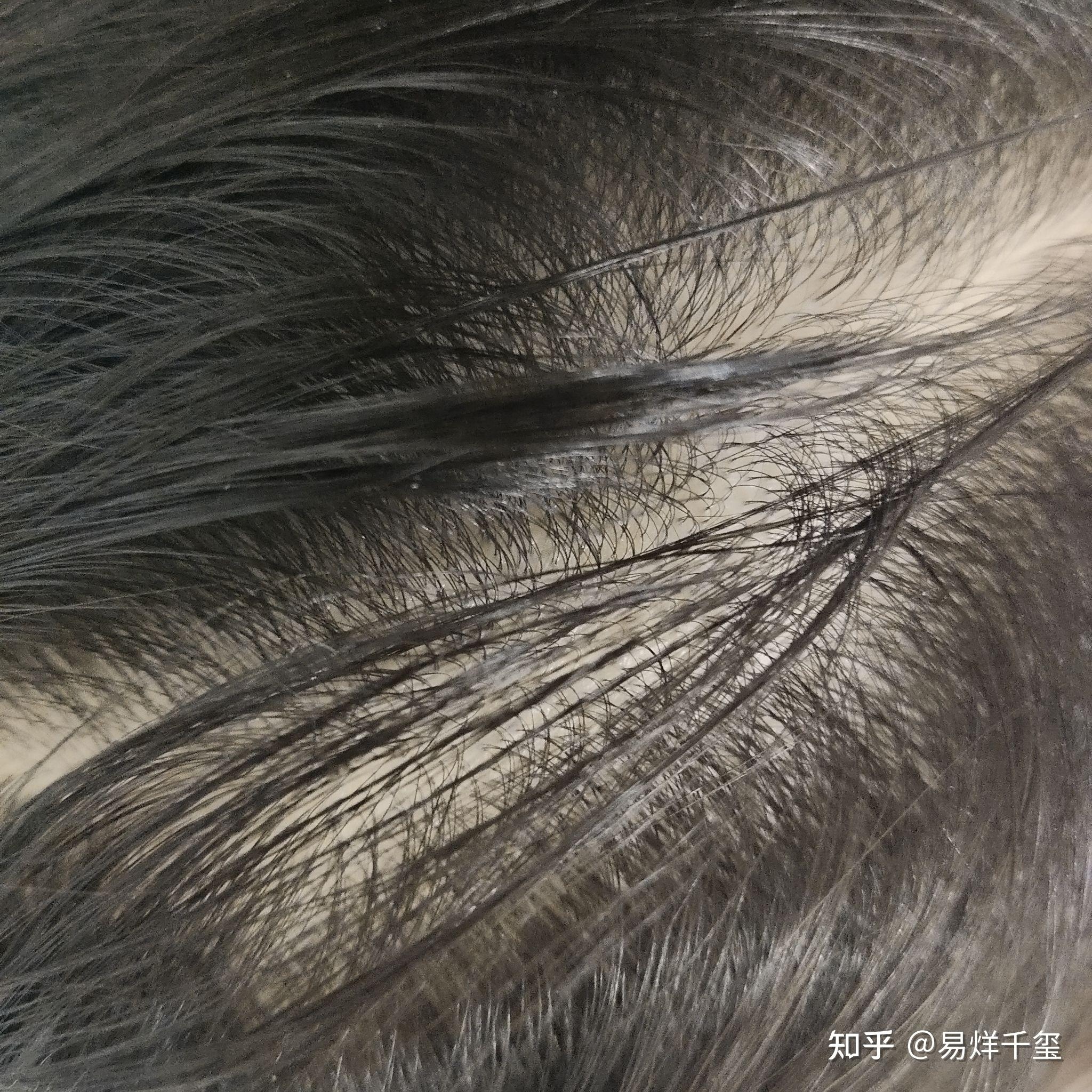 梦见秃头，探寻内心真实的秃头形态插图