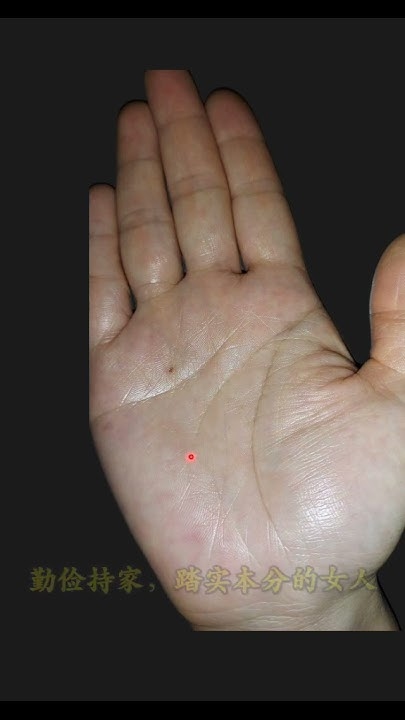 女人手背痣，传统寓意与现代解读的碰撞插图