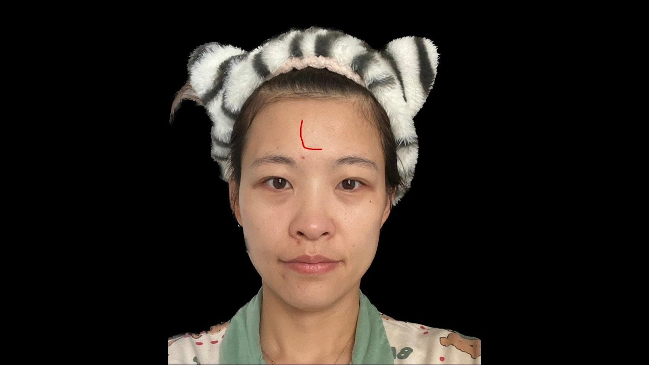 女人痣相，解读面相学中的神秘符号插图