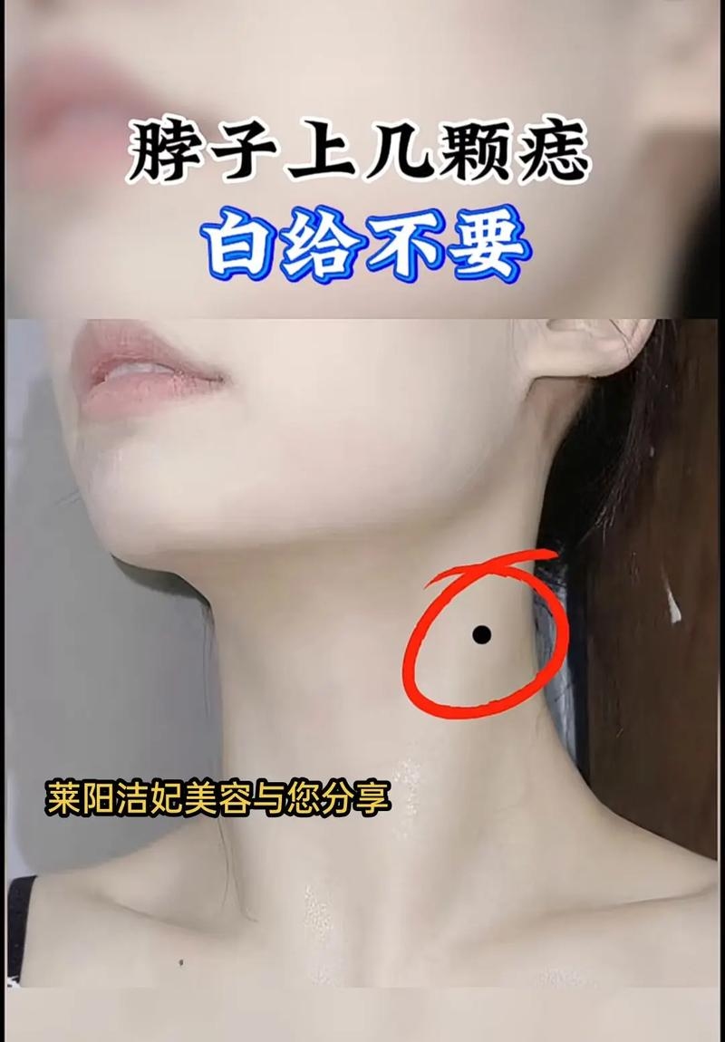 女人脖子痣相，恋爱婚姻稳定，富贵吉祥或劳碌奔波插图