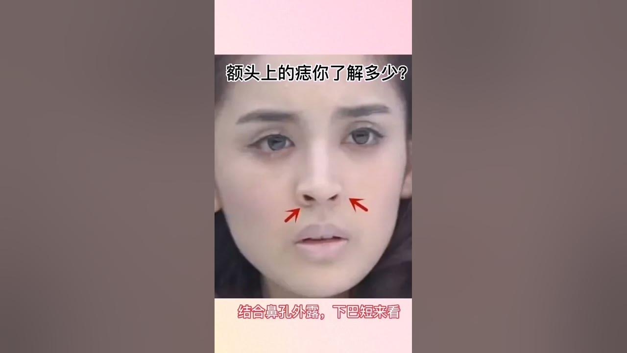 人中有痣，面相学中的微妙奥秘与传统文化解读插图