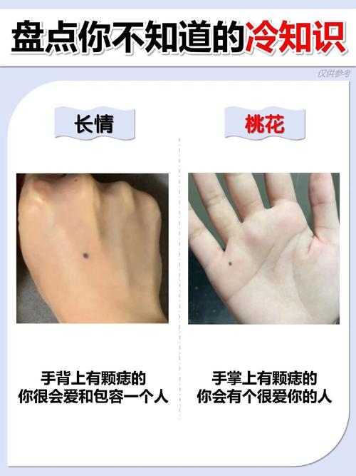 手背上的痣，命运的印记与个性的彰显插图