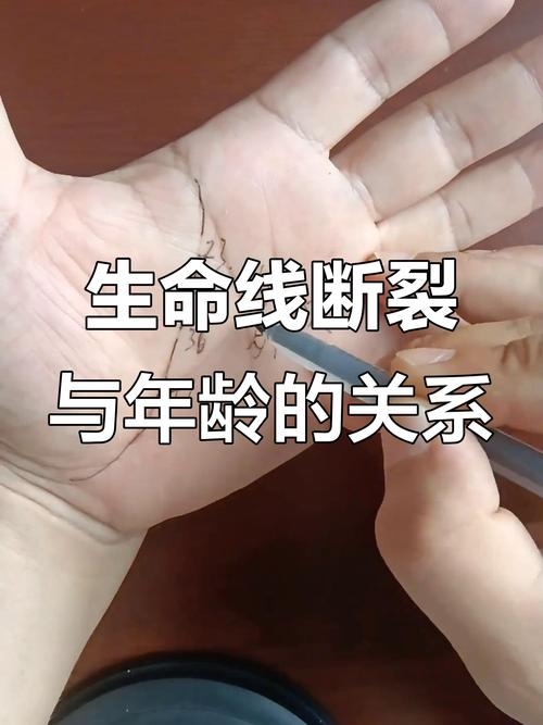 生命线断裂，当生命的连接陷入缝隙，何为最脆弱的锚点？插图
