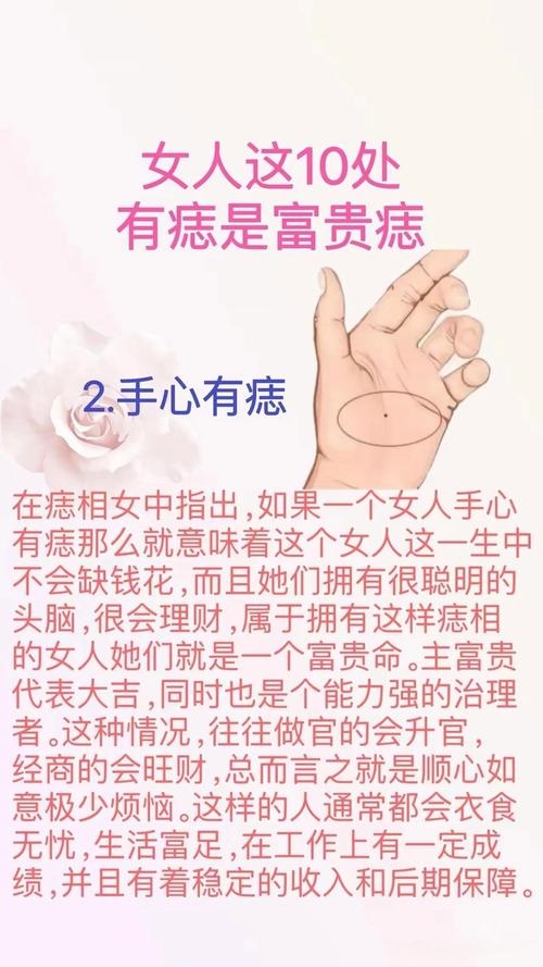 手相有福痣，女人富贵命！插图