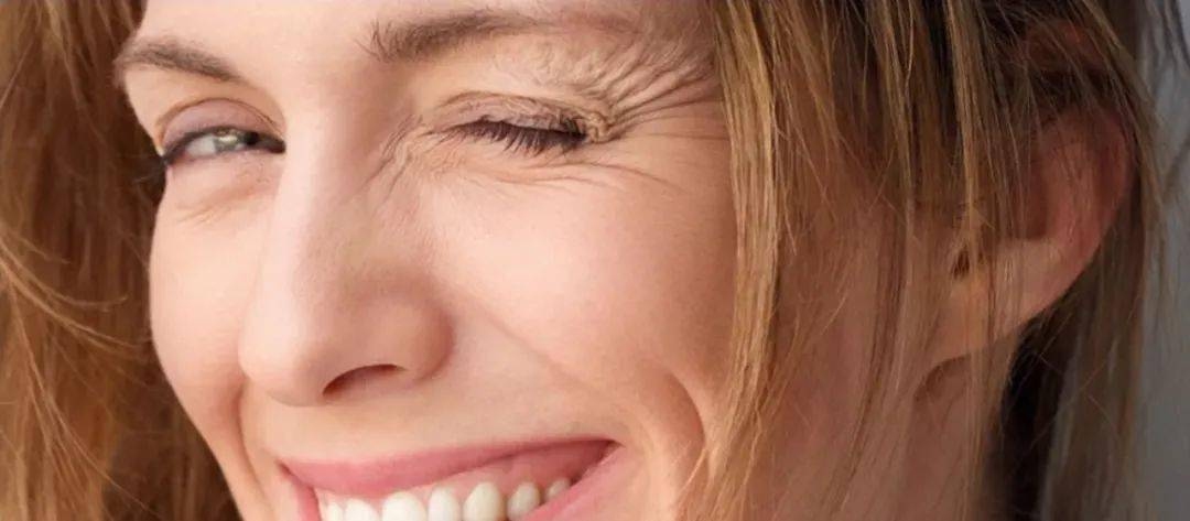 天生鱼尾纹，美丽与自信的优雅诠释插图