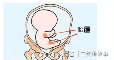 胎记与命运，科学态度下的美好向往插图