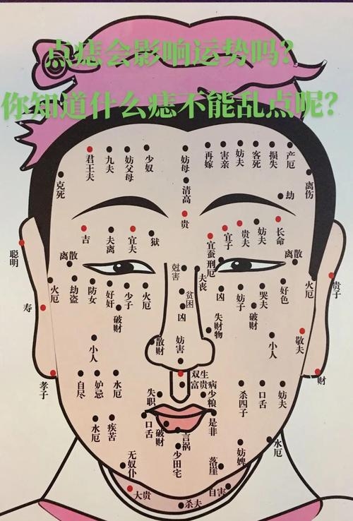 痣位相关解析插图