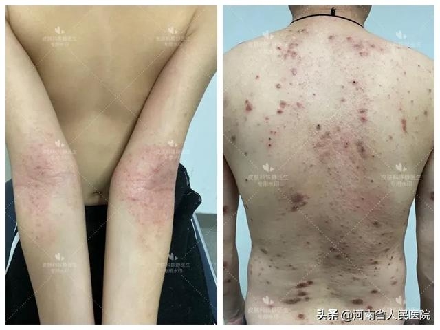 痣相大全，揭开人类身上隐藏的神秘面纱插图