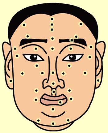 痣相解读，面部吉凶与命运关联全解析插图