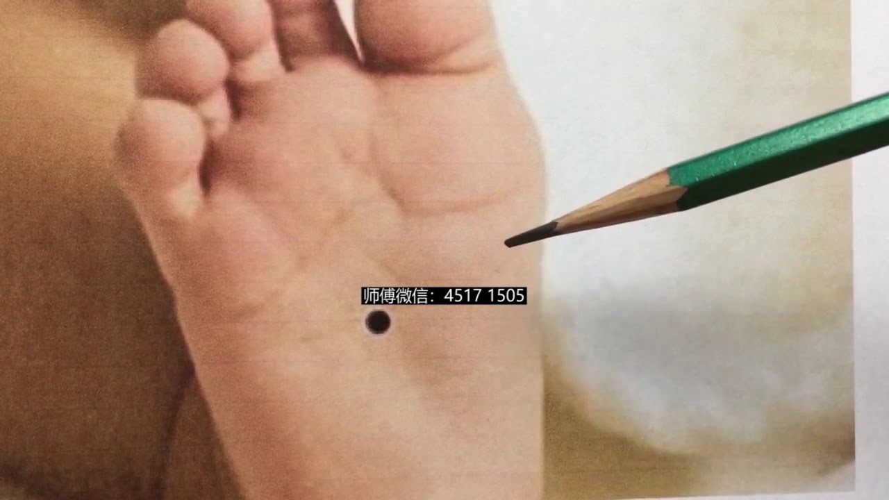 揭秘脚下有痣，古老传说与现代科学的交织插图