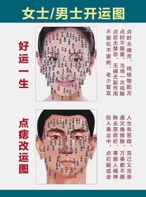 鼻翼两侧长痣,解读命运与美丽的神秘符号插图 鼻翼两侧长痣,解读命运与美丽的神秘符号插图