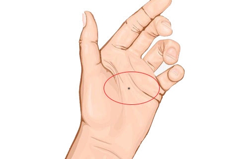 掌心痣寓意多，财运事业顺遂。插图