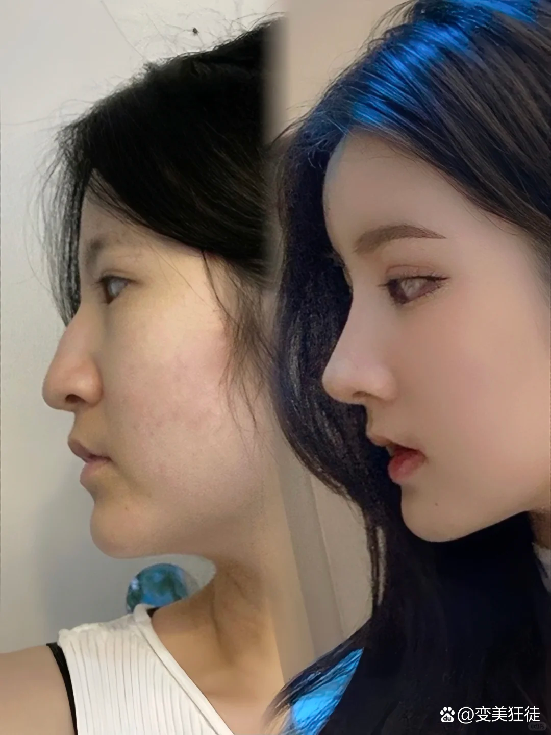 鹰钩鼻子的美学与文化寓意插图