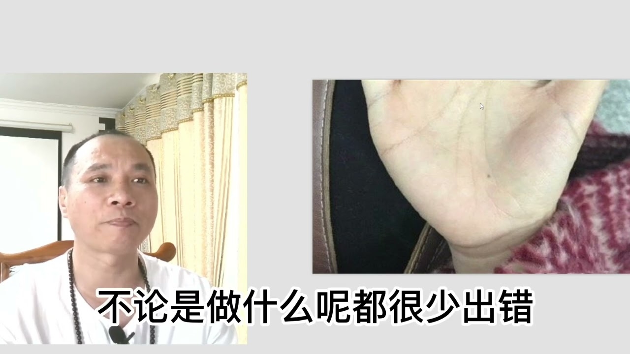 掌心有痣，窥见生命里微妙的秘密插图