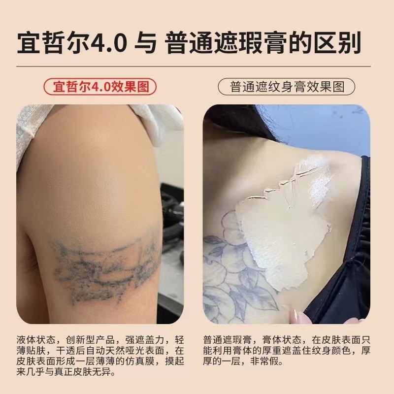 掌心有痣，命运的印记，还是巧合的印记？插图