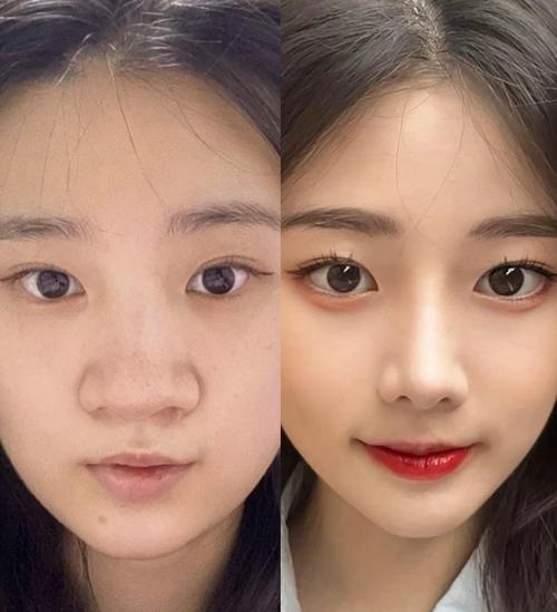 塌鼻子面相，传统观念与现代视角的碰撞插图