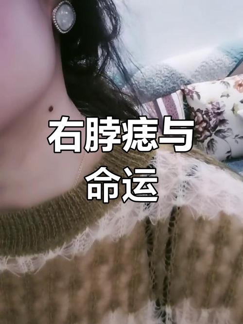 脖子有痣代表事业发展好、财运亨通；左右两侧则象征才华与可靠之人。插图