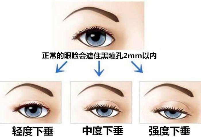 眼角的秘密,上扬的魅力与性格解析插图 眼角的秘密,上扬的魅力与性格解析插图