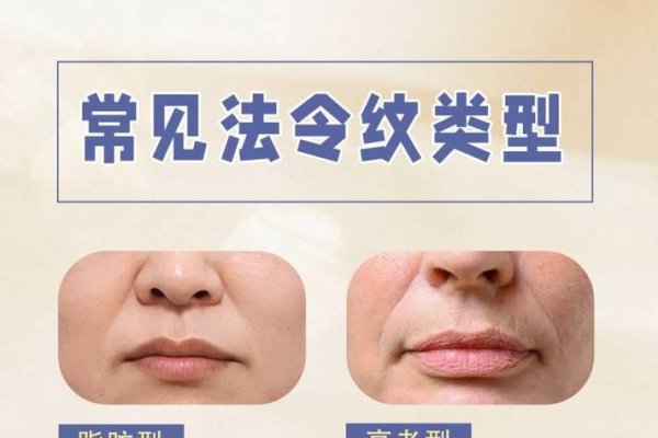 法令纹不对称，面相解读与性格影响-方知甜