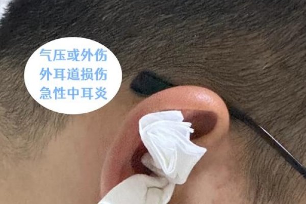 梦到耳朵流血需谨慎解读-方知甜