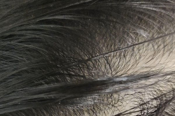 梦见秃头，探寻内心真实的秃头形态-方知甜