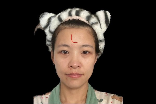 女人痣相，解读面相学中的神秘符号-方知甜