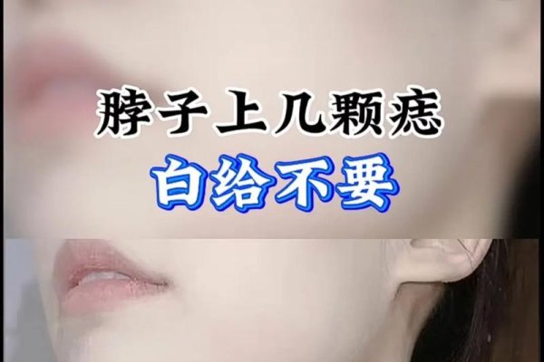 女人脖子痣相，恋爱婚姻稳定，富贵吉祥或劳碌奔波-方知甜