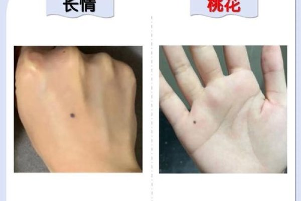 手背上的痣，命运的印记与个性的彰显-方知甜