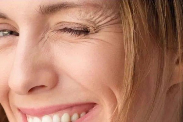 天生鱼尾纹，美丽与自信的优雅诠释-方知甜