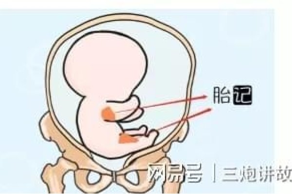 胎记与命运，科学态度下的美好向往-方知甜