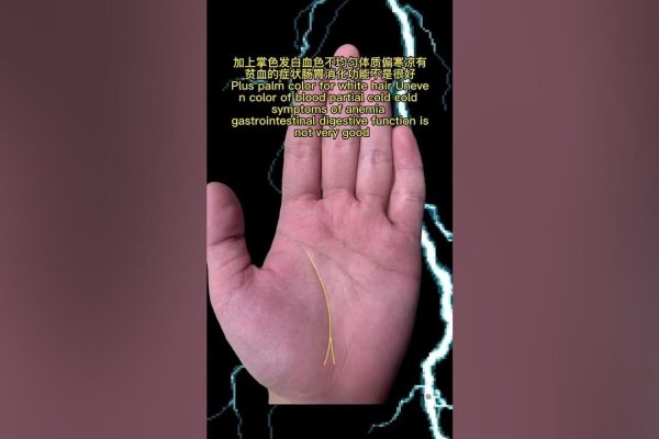 男人生命线分叉，解读命运与性格的奥秘-方知甜