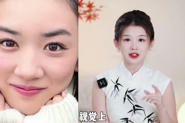 蒜头鼻子的魅力，独特之美，不凡之韵-方知甜