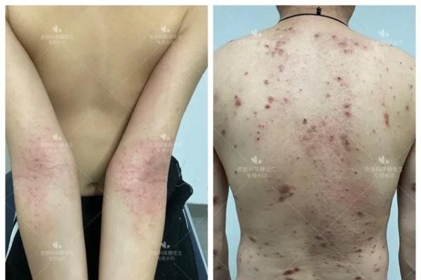 痣相大全，揭开人类身上隐藏的神秘面纱-方知甜