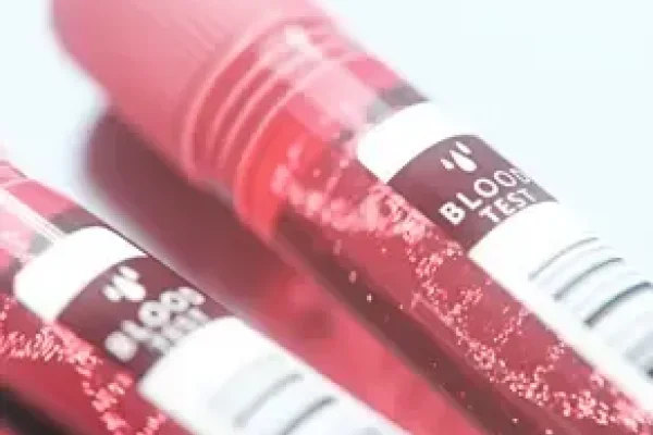 血型分析，精准解读血型，助力健康决策-方知甜