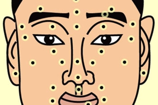 痣相解读，面部吉凶与命运关联全解析-方知甜