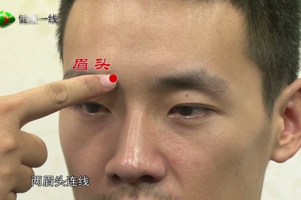 揭秘人体穴位，印堂的神秘所在-方知甜