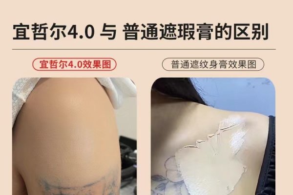 掌心有痣，命运的印记，还是巧合的印记？-方知甜