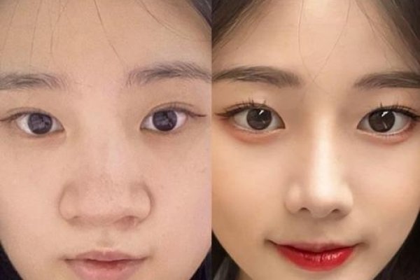 塌鼻子面相，传统观念与现代视角的碰撞-方知甜