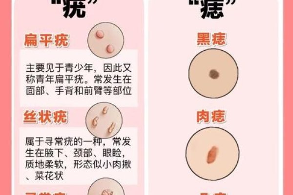痦子的位置，科学视角下的认知与预防指南-方知甜