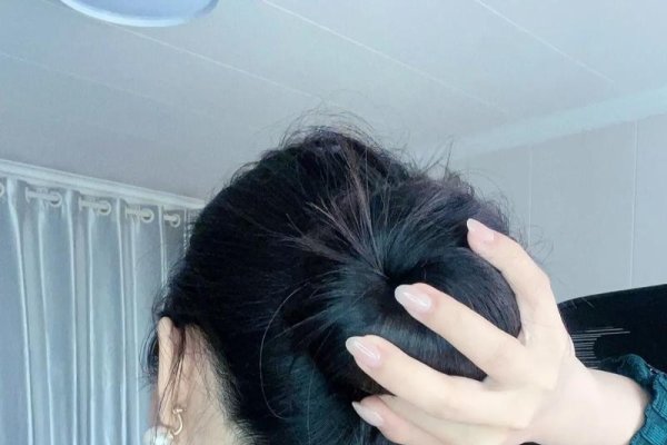 脖子后痣象征靠山，财富丰裕-方知甜