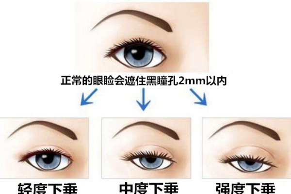 眼角的秘密，上扬的魅力与性格解析-方知甜